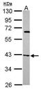 Actin Related Protein 2/3 Complex Subunit 1B antibody, GTX115343, GeneTex, Western Blot image 