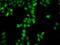 HDGF Like 2 antibody, GTX33237, GeneTex, Immunocytochemistry image 