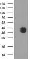 V-Set And Immunoglobulin Domain Containing 2 antibody, TA502162, Origene, Western Blot image 