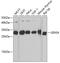 GINS Complex Subunit 4 antibody, GTX66532, GeneTex, Western Blot image 