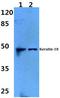 KRT18 antibody, A01357S48, Boster Biological Technology, Western Blot image 