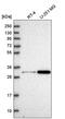 LRAT Domain Containing 2 antibody, PA5-65676, Invitrogen Antibodies, Western Blot image 
