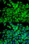 Eukaryotic initiation factor 4A-I antibody, 19-567, ProSci, Immunofluorescence image 
