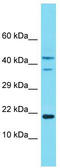 NADH:Ubiquinone Oxidoreductase Subunit A8 antibody, TA343216, Origene, Western Blot image 