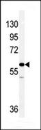 Vimentin antibody, TA324729, Origene, Western Blot image 