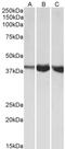 Aldolase, Fructose-Bisphosphate A antibody, TA327767, Origene, Western Blot image 