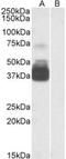 P2X purinoceptor 7 antibody, LS-B4401, Lifespan Biosciences, Western Blot image 