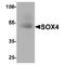SRY-Box 4 antibody, TA349150, Origene, Western Blot image 