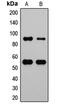 Hdm2 antibody, LS-C354039, Lifespan Biosciences, Western Blot image 