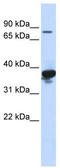LON Peptidase N-Terminal Domain And Ring Finger 2 antibody, TA331526, Origene, Western Blot image 