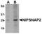 Nipsnap Homolog 2 antibody, NBP1-77339, Novus Biologicals, Western Blot image 