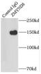 Zinc Finger MYND-Type Containing 8 antibody, FNab09652, FineTest, Immunoprecipitation image 