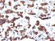 Thyroglobulin antibody, V2883IHC-7ML, NSJ Bioreagents, Immunohistochemistry paraffin image 