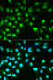 Protein Phosphatase 3 Catalytic Subunit Alpha antibody, 13-765, ProSci, Immunofluorescence image 