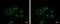 Cleavage and polyadenylation specificity factor subunit 2 antibody, GTX117730, GeneTex, Immunocytochemistry image 