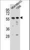 Forkhead Box D4 antibody, LS-C166221, Lifespan Biosciences, Western Blot image 