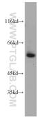 Fms Related Tyrosine Kinase 1 antibody, 13687-1-AP, Proteintech Group, Western Blot image 