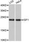Insulin Like Growth Factor 1 antibody, abx125982, Abbexa, Western Blot image 