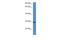 N-alpha-acetyltransferase 11, NatA catalytic subunit antibody, A12649, Boster Biological Technology, Western Blot image 