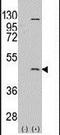 Protein Arginine Methyltransferase 8 antibody, PA5-11310, Invitrogen Antibodies, Western Blot image 