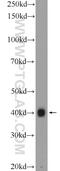 Chloride Nucleotide-Sensitive Channel 1A antibody, 25964-1-AP, Proteintech Group, Western Blot image 