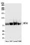 Metastasis Associated 1 antibody, A300-911A, Bethyl Labs, Western Blot image 
