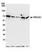 Protein Kinase C Substrate 80K-H antibody, A304-745A, Bethyl Labs, Western Blot image 