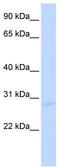 Spi-C Transcription Factor antibody, TA345537, Origene, Western Blot image 
