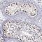 SRY-Box 9 antibody, NBP1-85551, Novus Biologicals, Immunohistochemistry frozen image 