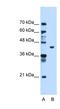Phosphoglycerate Kinase 1 antibody, NBP1-55154, Novus Biologicals, Western Blot image 