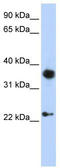 Homeobox protein engrailed-1 antibody, TA330136, Origene, Western Blot image 