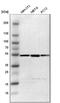 Proteasome 26S Subunit, ATPase 4 antibody, NBP1-87799, Novus Biologicals, Western Blot image 