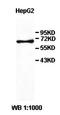 Phosphoacetylglucosamine mutase antibody, orb77997, Biorbyt, Western Blot image 