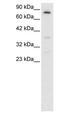 Forkhead Box E3 antibody, PA1-24458, Invitrogen Antibodies, Western Blot image 