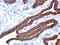 Mucin 1, Cell Surface Associated antibody, GTX34855, GeneTex, Immunohistochemistry paraffin image 