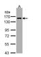 LIM And Calponin Homology Domains 1 antibody, LS-C186014, Lifespan Biosciences, Western Blot image 