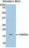 Oncomodulin antibody, LS-C295716, Lifespan Biosciences, Western Blot image 