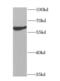 LDM antibody, FNab02176, FineTest, Western Blot image 