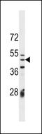 Izumo Sperm-Egg Fusion 1 antibody, LS-C159947, Lifespan Biosciences, Western Blot image 