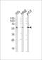 Phosphatidylinositol-4-Phosphate 5-Kinase Like 1 antibody, LS-C163736, Lifespan Biosciences, Western Blot image 