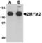 Zinc finger protein 198 antibody, LS-B7027, Lifespan Biosciences, Western Blot image 
