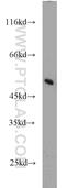 Mitochondrial Ribosomal Protein L37 antibody, 15190-1-AP, Proteintech Group, Western Blot image 
