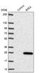 B9 Domain Containing 2 antibody, NBP1-91694, Novus Biologicals, Western Blot image 