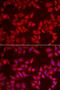 Ubiquitin carboxyl-terminal hydrolase BAP1 antibody, orb247479, Biorbyt, Immunofluorescence image 