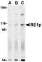 Serine/threonine-protein kinase/endoribonuclease IRE1 antibody, TA306274, Origene, Western Blot image 
