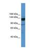 Oxoglutarate Dehydrogenase Like antibody, NBP1-91486, Novus Biologicals, Western Blot image 