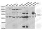CDK5 Regulatory Subunit Associated Protein 1 Like 1 antibody, A5771, ABclonal Technology, Western Blot image 