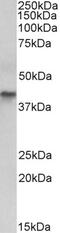 Keratin 18 antibody, 43-489, ProSci, Immunofluorescence image 