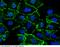 Catenin Beta 1 antibody, 11279-R021, Sino Biological, Immunohistochemistry frozen image 