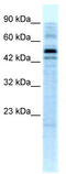 STON1-GTF2A1L protein antibody, TA329314, Origene, Western Blot image 